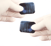 radiodiagnostic-dentar